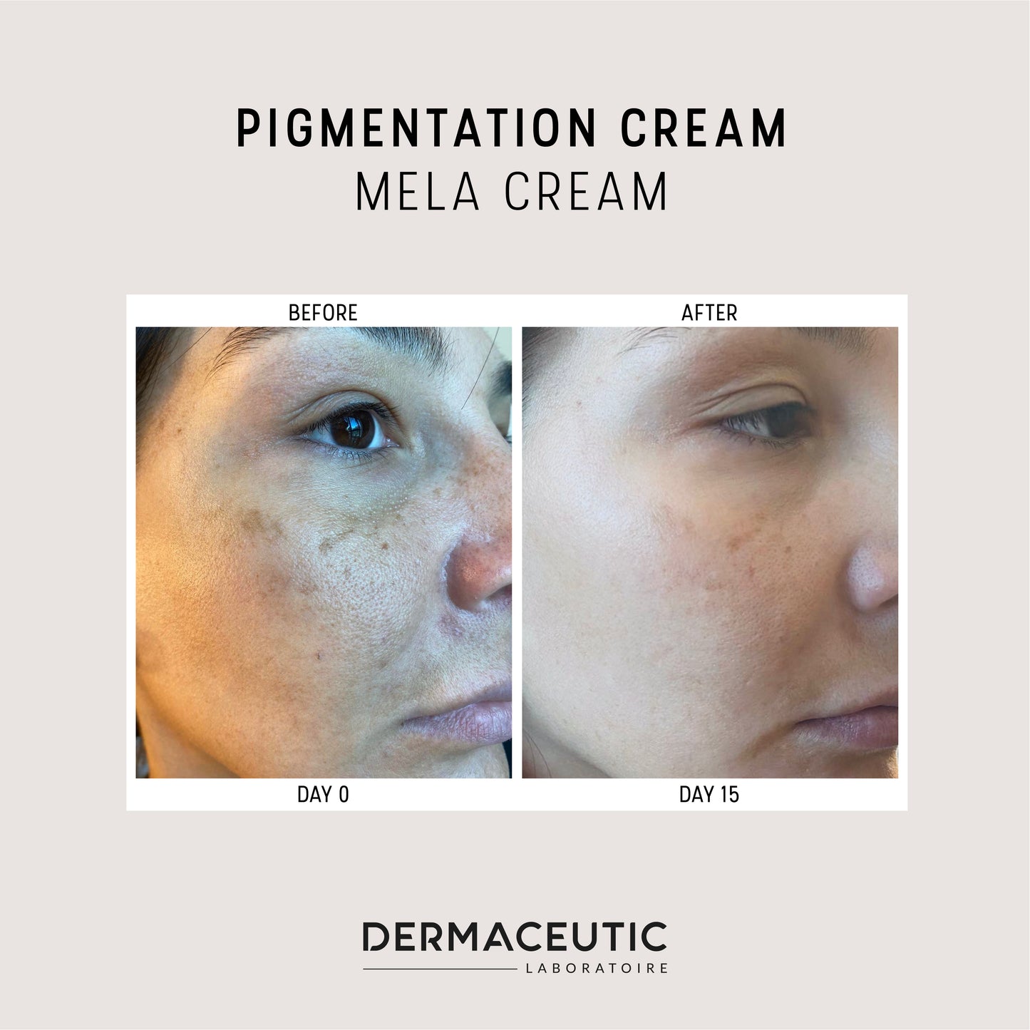 Dermaceutic Mela Pigmentation Cream 30ml