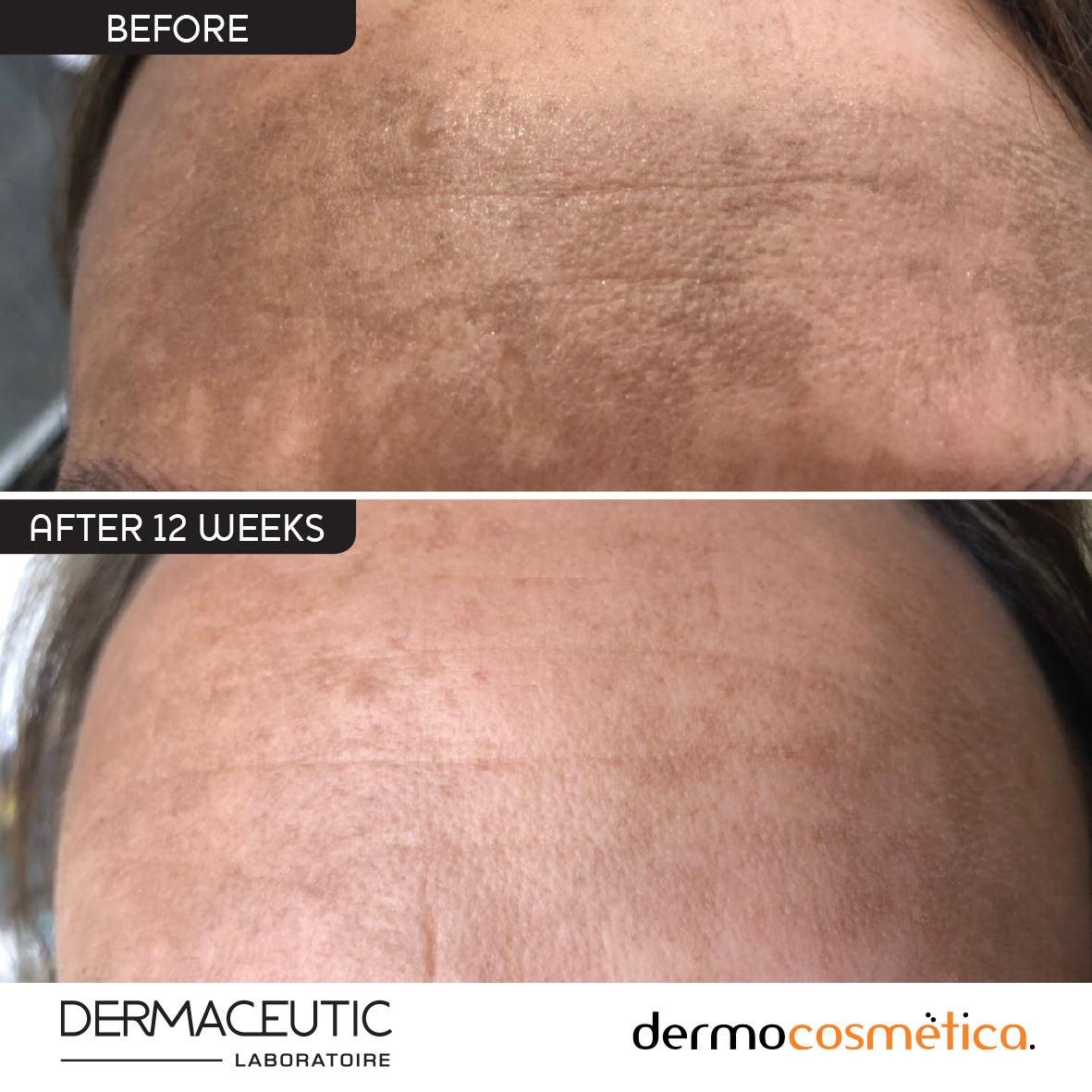 Dermaceutic Mela Pigmentation Cream 30ml